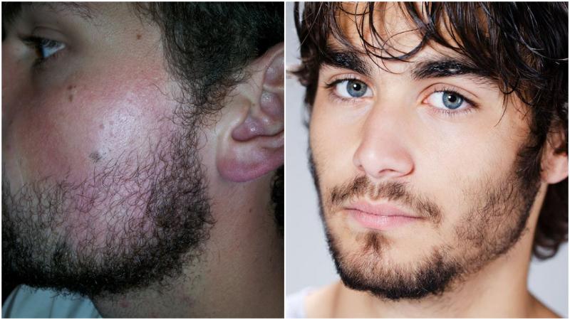 Blue Devils Facial Hair: How to Grow and Maintain Your Beard - wide 7