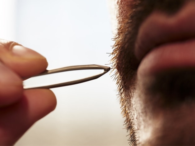 removing ingrown hair from beard