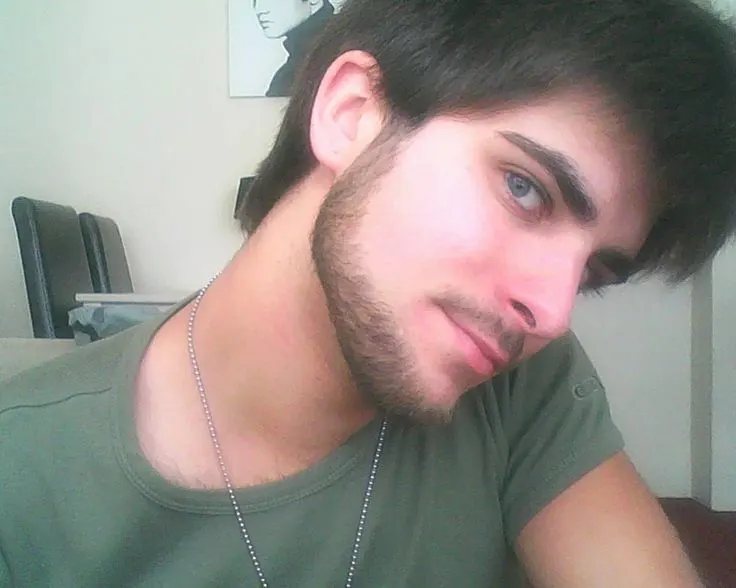 Patchy Beard 8