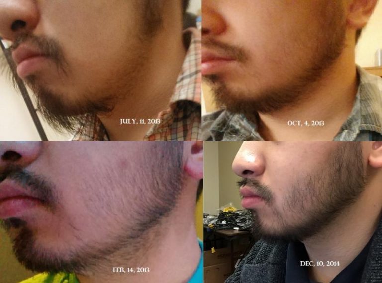 Как замедлить рост волос после бритья на лице у мужчин