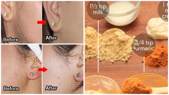 How To Remove Facial Hair INSTANTLY At Home 