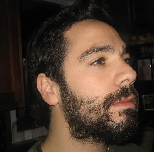 growing uneven beard