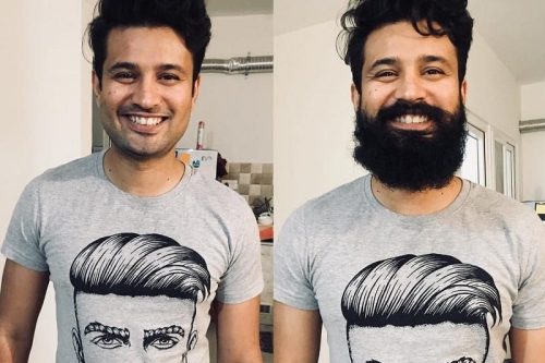 45 Amazing Beard Before and After Transformation Photos