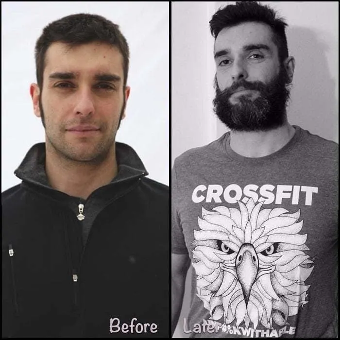 thick beard before and after