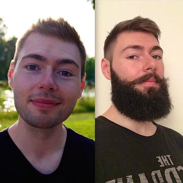 45 Amazing Beard Before And After Transformation Photos 2022 