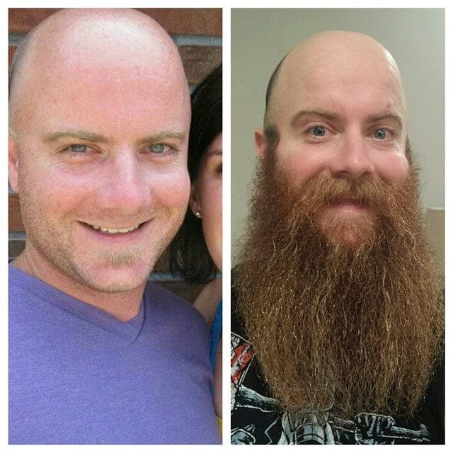 long beard before and after look