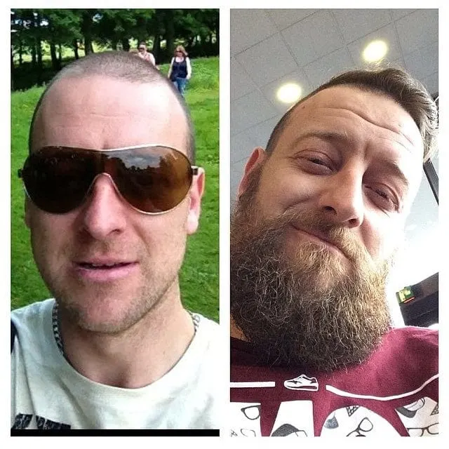 before and after look of scruffy beard