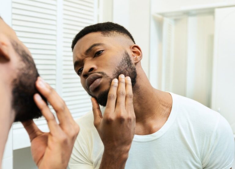 Black Men Beard Problems