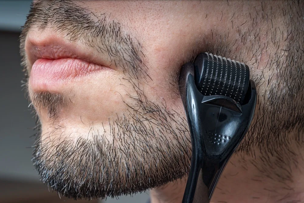 Dermarolling to remove peach fuzz beard