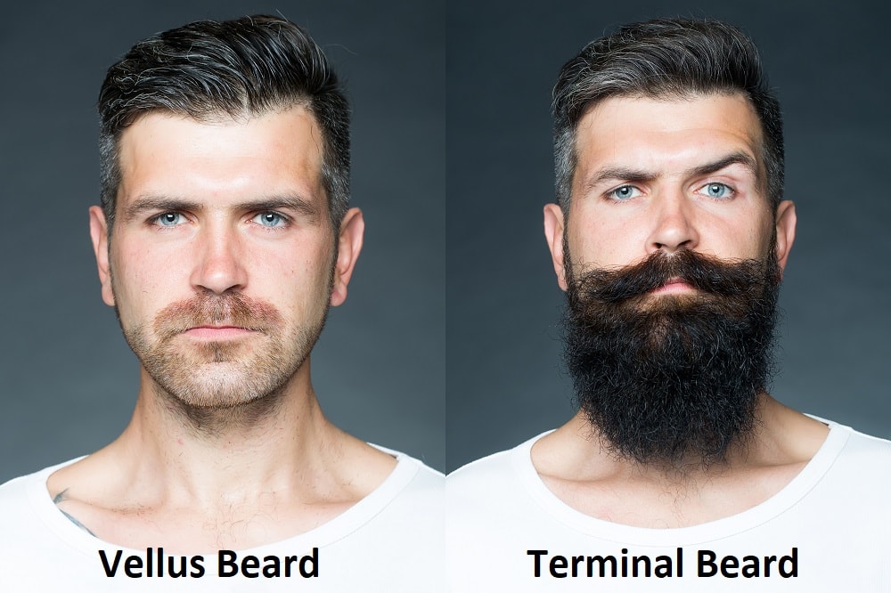 Difference Between Vellus Beard Hair and Terminal Beard