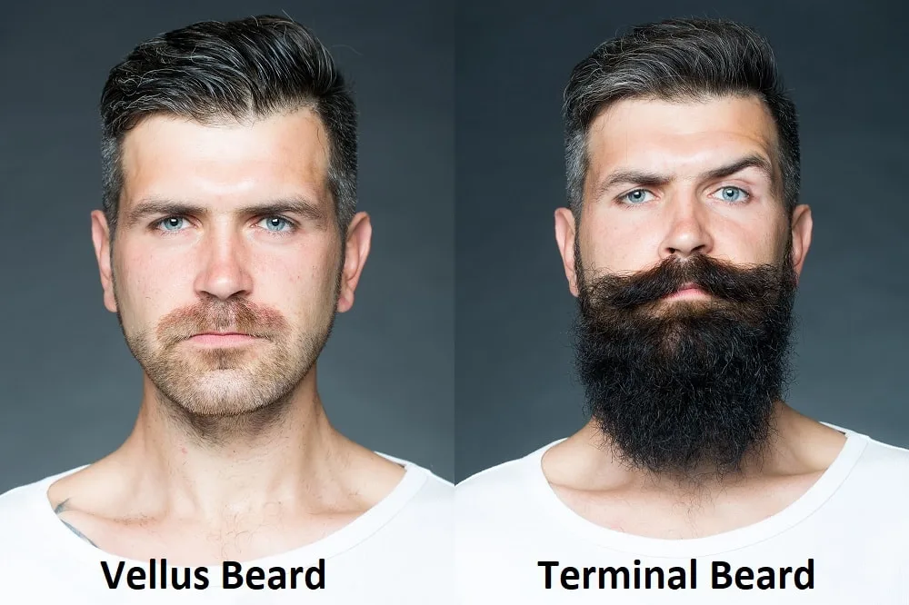 Differenza tra i capelli della barba in vellus e la barba terminale