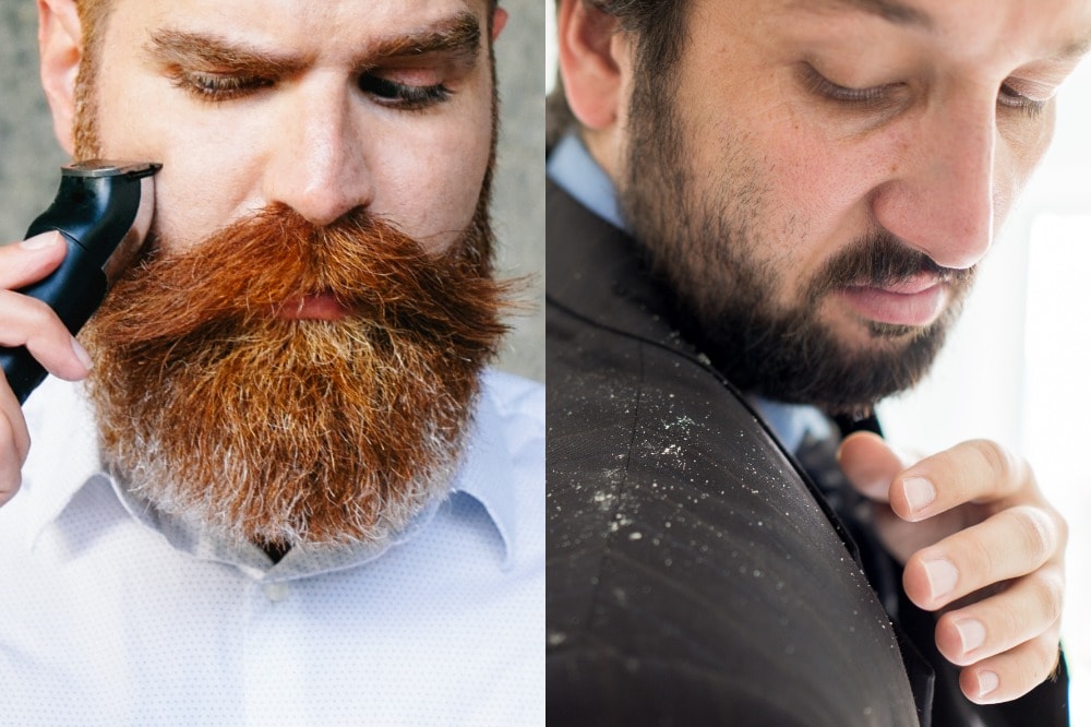 Pros and Cons of Having A 3 Month Beard