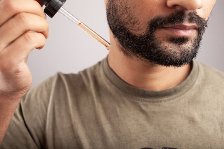 Are Minoxidil Beard Gains Permanent or Just A Temporary Fix?