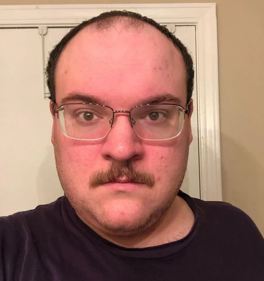 pyramid mustache on a balding man
